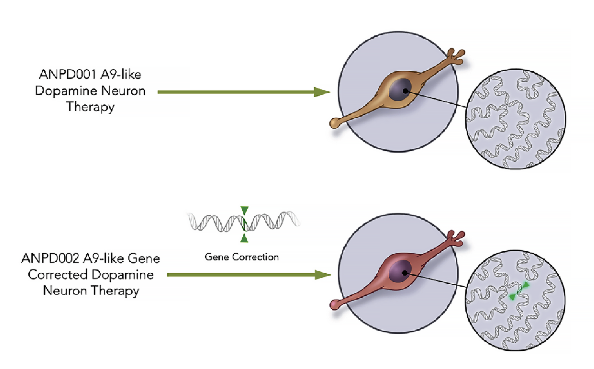 Anpd001 Aspen Neuroscience A Phase 1/2a Clinical Trial Update 2024 Aspen Neuroscience