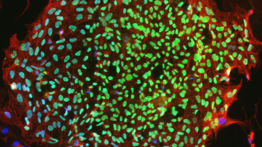 Aspen Neuroscience Advances the Automated Production of Personalized Autologous Cell Therapy for Parkinson’s Disease